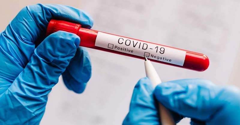 Chỉ khi có biểu hiện hoặc cần điều tra dịch tễ đến từ vùng cấp độ 3 hoặc 4 thì mới phải xét nghiệm COVID